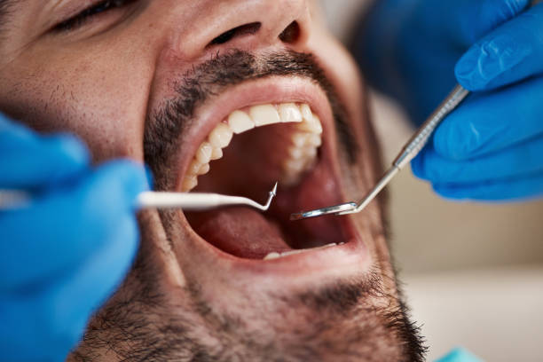 Teeth Whitening in TN