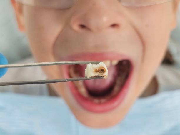 Emergency Gum Pain Relief in TN