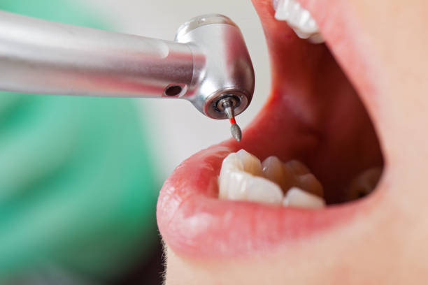 Tooth Infection Emergency Dentist in TN